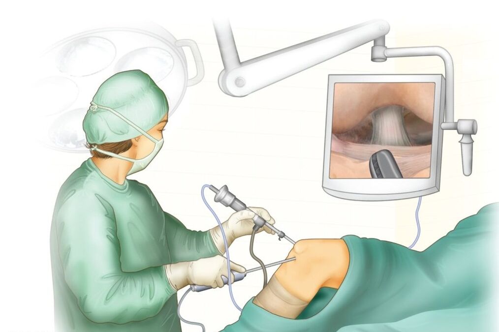 Cirurgia da articulação do joelho