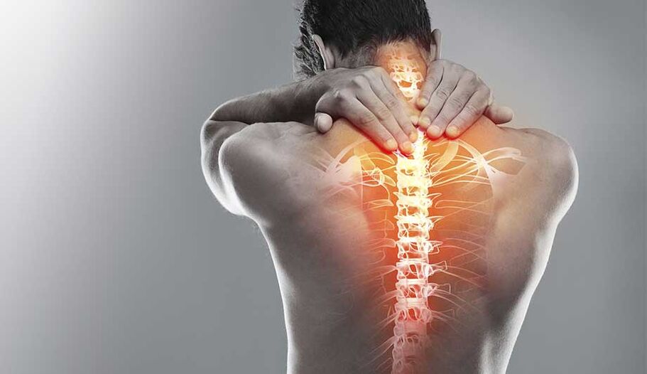 Dor na coluna devido à osteocondrose