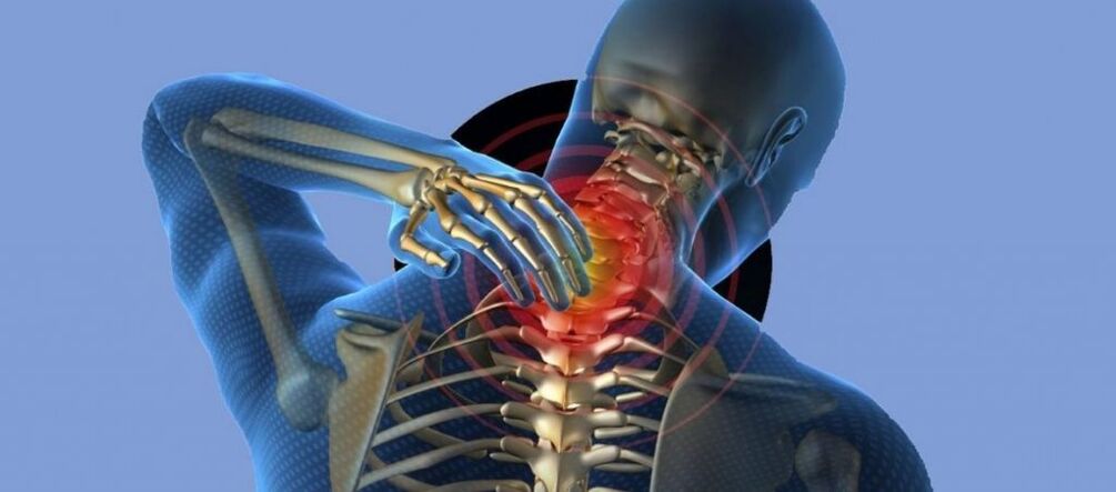 Osteocondrose da coluna cervical