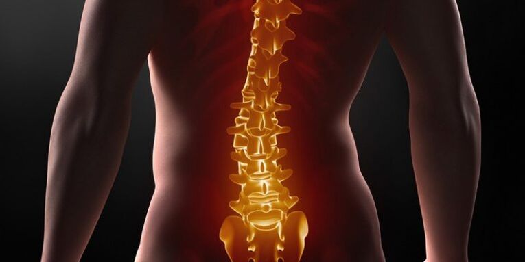 Osteocondrose da coluna sacral