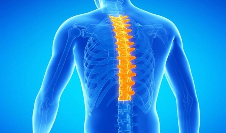 Osteocondrose da coluna torácica