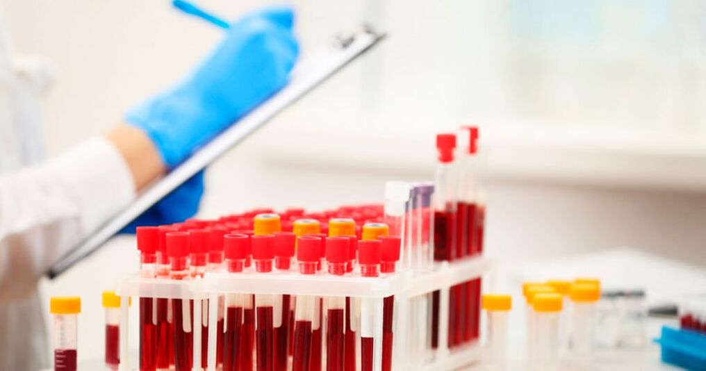 Realizando um exame de sangue para detectar inflamação